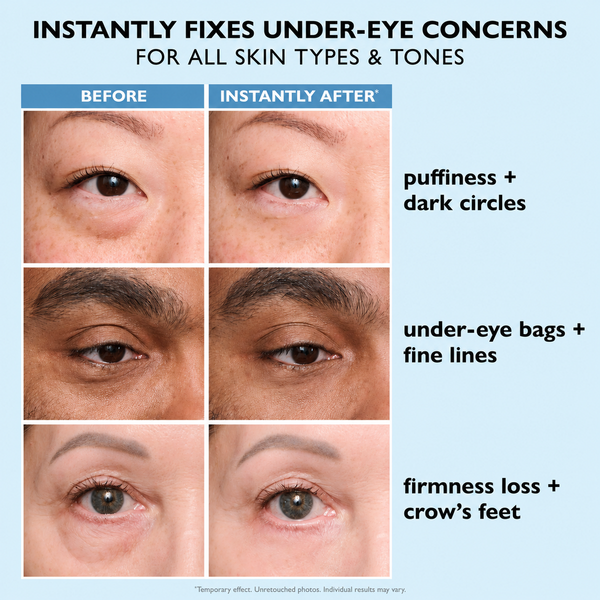 Instant FIRM-x Temporary Eye Tightener